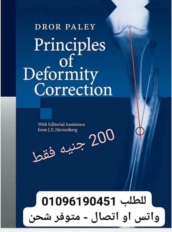 Dror paley principles of deformity correction