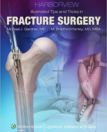 HARBOURVIEW tips and tricks in fracture surgery