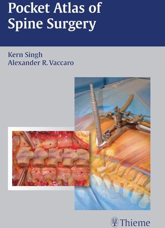 Pocket Atlas of Spine Surgery