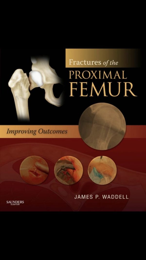 fractures of the proximal femur