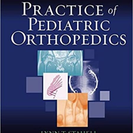 practice of pediatric orthopedics