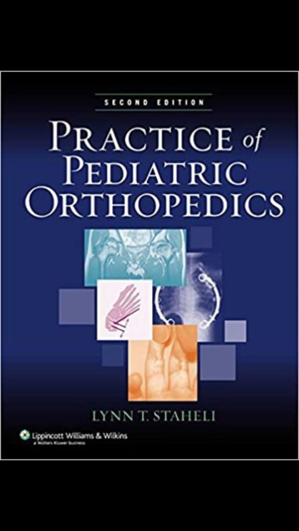 practice of pediatric orthopedics