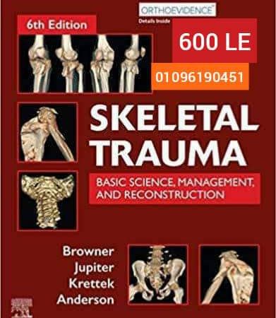 skeletal trauma