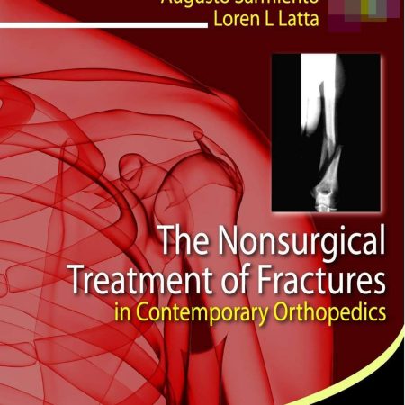 the nonsurgical treatment of fractures in contemporary orthopedics