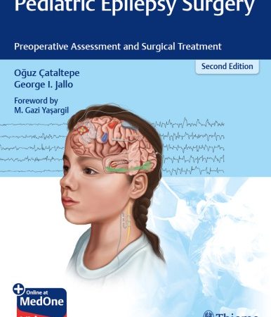 pediatric epilepsy surgery  preoperative assessment and surgical treatment