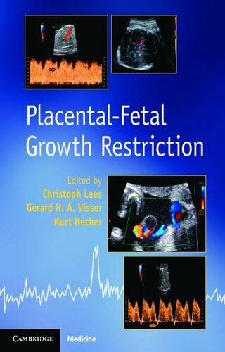 Placental-fetal growth restriction