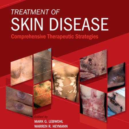 Treatment of Skin Disease: Comprehensive Therapeutic Strategies