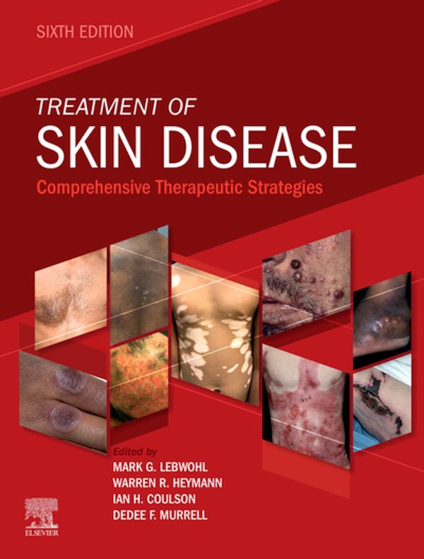 Treatment of Skin Disease: Comprehensive Therapeutic Strategies