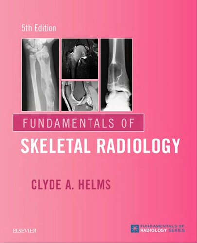 Fundamentals of Skeletal Radiology