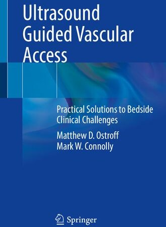 Ultrasound Guided Vascular Access: Practical Solutions to Bedside Clinical Challenges