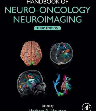 Handbook of Neuro-Oncology Neuroimaging