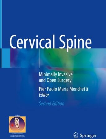 Cervical spine : minimally invasive and open surgery