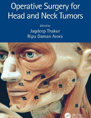 Operative Surgery for Head and Neck Tumors