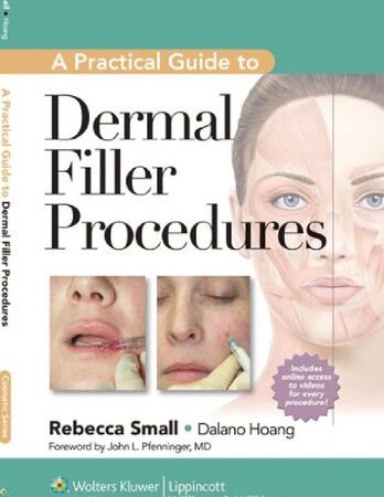 A Practical Guide to Dermal Filler Procedures