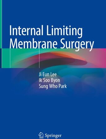 Internal Limiting Membrane Surgery