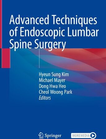 Advanced Techniques of Endoscopic Lumbar Spine Surgery