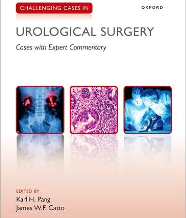 Challenging Cases in Urological Surgery