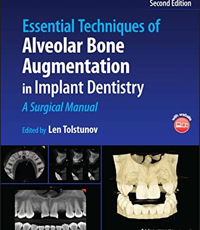 Essential Techniques of Alveolar Bone Augmentation in Implant Dentistry: A Surgical Manual