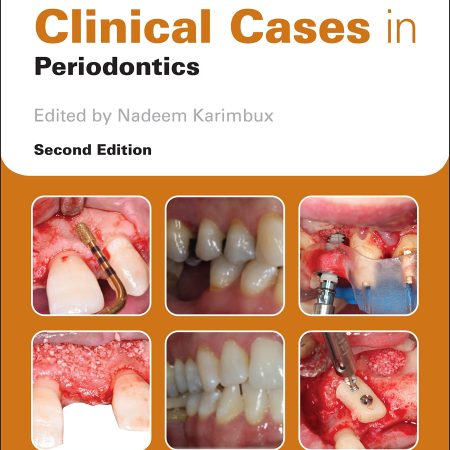 Clinical Cases in Periodontics