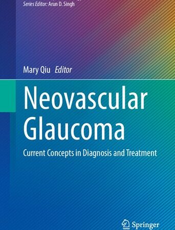 Neovascular Glaucoma: Current Concepts in Diagnosis and Treatment