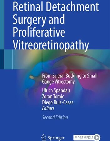 Retinal Detachment Surgery and Proliferative Vitreoretinopathy: From Scleral Buckling to Small Gauge Vitrectomy