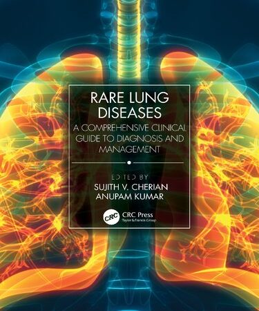 Rare Lung Diseases: A Comprehensive Clinical Guide to Diagnosis and Management