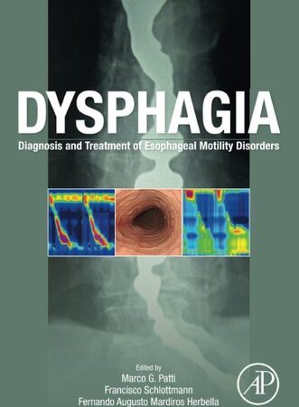 Dysphagia: Diagnosis and Treatment of Esophageal Motility Disorders